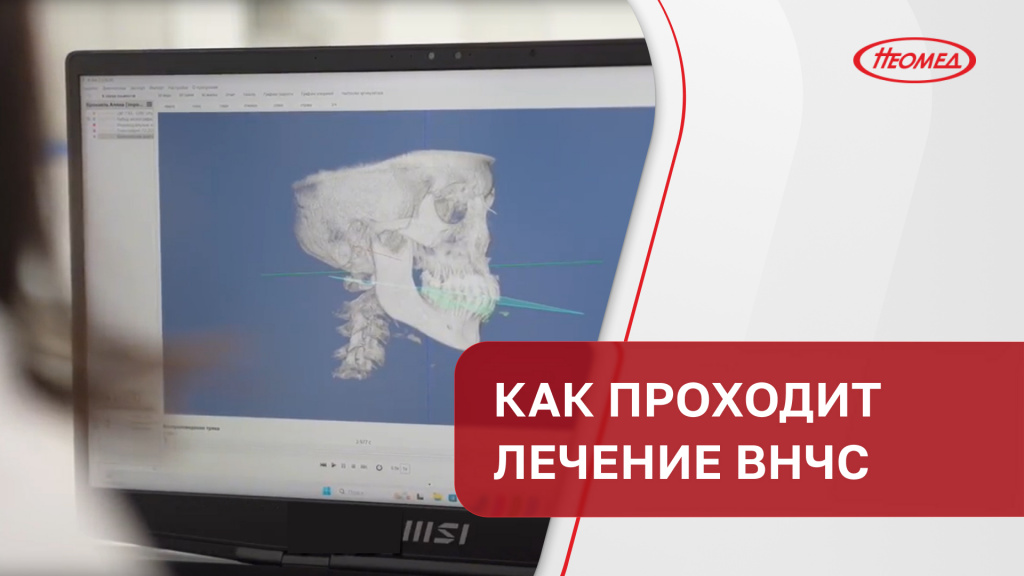 Как проходит лечение ВНЧС